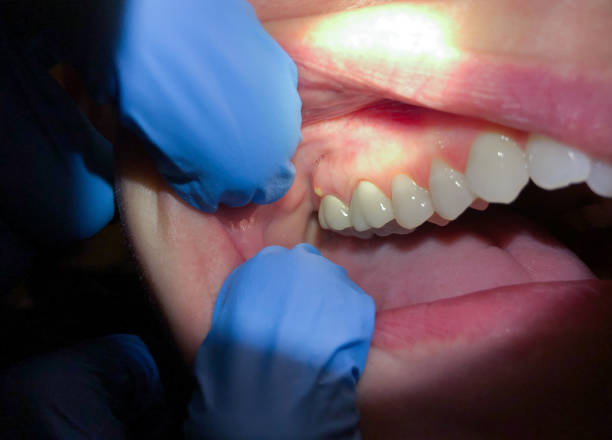 Best Broken Tooth Emergency  in Landrum, SC